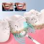 ProClean Electric Teeth Whitening Tool Bulk Christmas Gifts - Removes Tough CalculusTartar, And Smoke Stains Effortlessly - Professional-Grade DentalHygiene For A Brighter Smile At Home