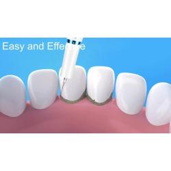 [Sonic Tooth Cleaner] 5-Speed Portable Sonic Electric Tooth Cleaner with LED Light - USB Rechargeable Tartar Removal Device, Lithium Battery, Type-C Charging for Home Dental Care